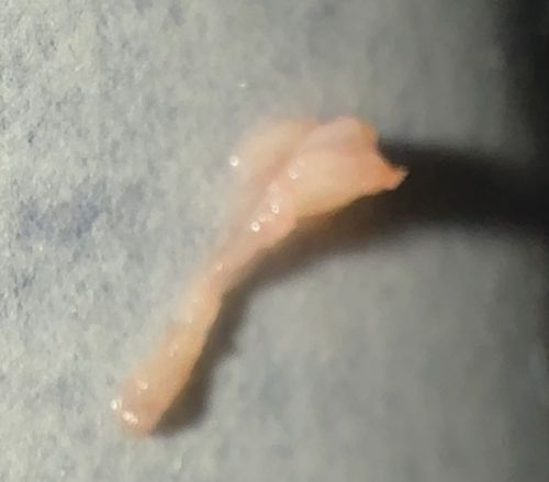 Pinworm
