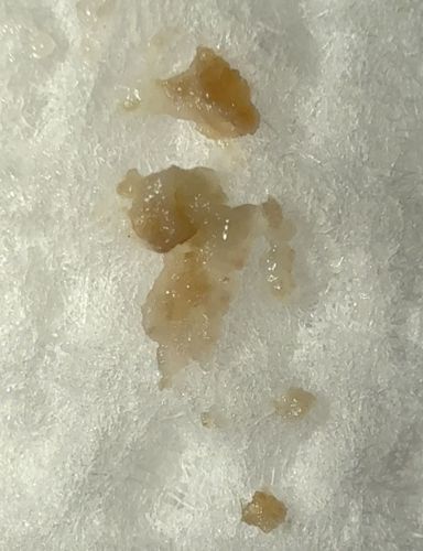 Not an insect (likely biological debris or secretion)