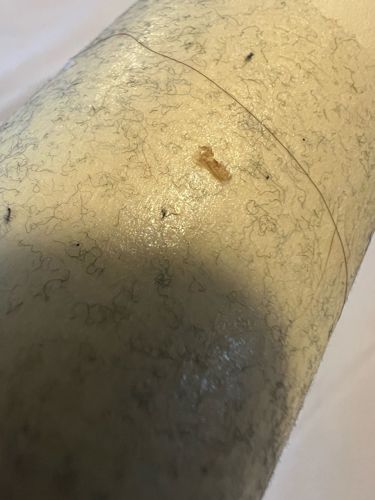 It is not possible to identify an insect from the provided image. The image appears to show skin with hair and some debris.