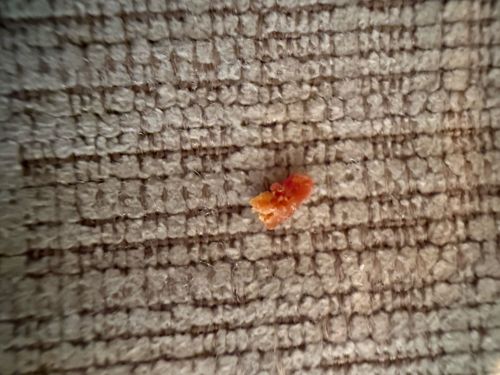 Unidentifiable organic material