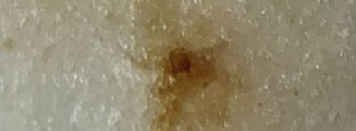 Not a Bug/Insect (Likely a Skin Lesion or Mole)