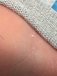 No insect or bug identifiable