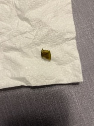 Unidentifiable Fragment (Likely Plant Matter)