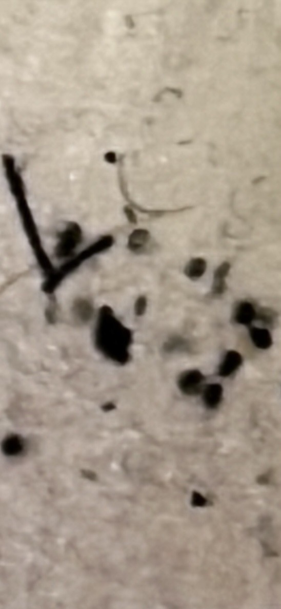 Inconclusive (Likely Non-Biological Debris)