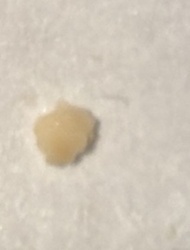 Brown widow spider egg sac