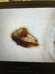 Unidentifiable insect fragment