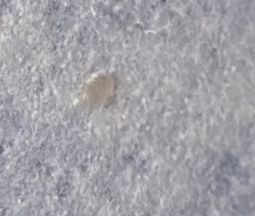 Pubic Louse
