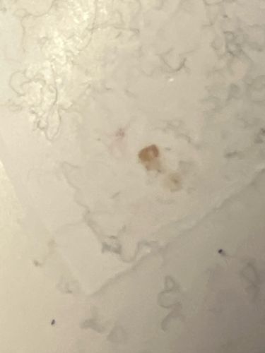 Too blurry to identify