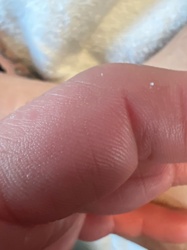 No insect or bug identifiable