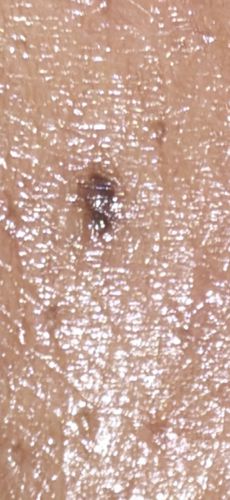Black legged tick (Deer tick)