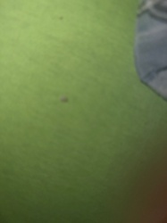 Unidentifiable tiny dark specks