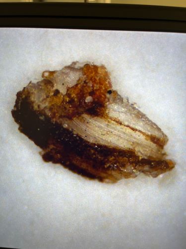 Unidentifiable organic material