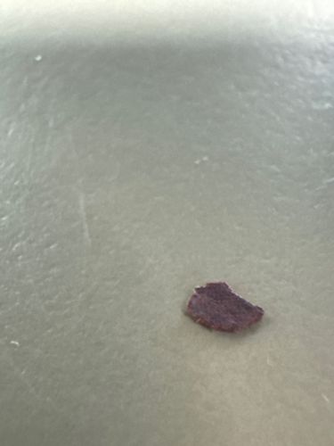 Inconclusive (Object resembles organic debris/scab)
