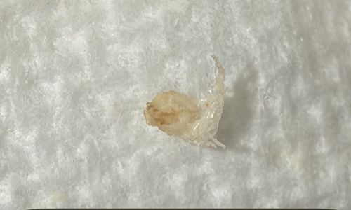 Bird Lice (Louse) / Mite