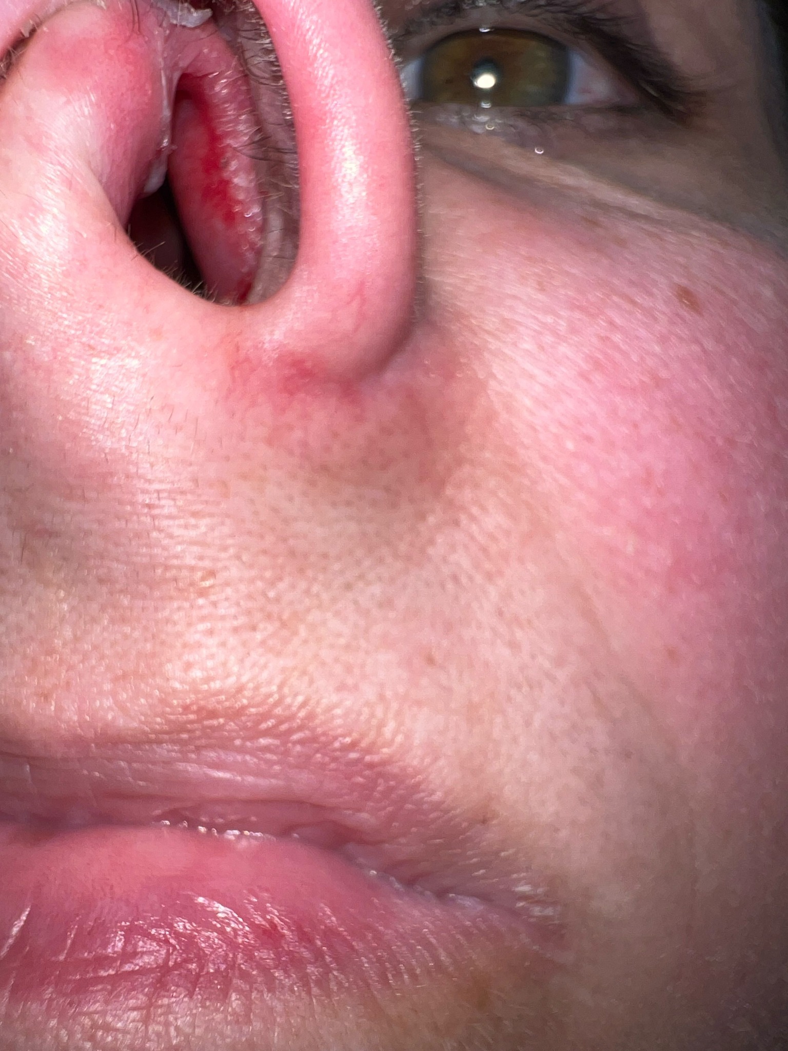 Unknown (No visible insect)