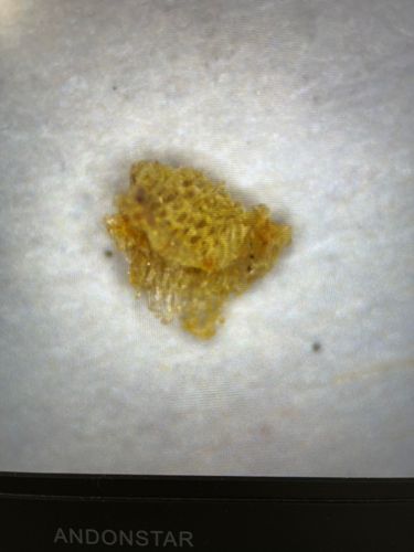 Lace Bug Nymph or Exuviae