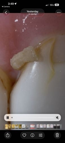 Unknown (Non-biological or Food debris)