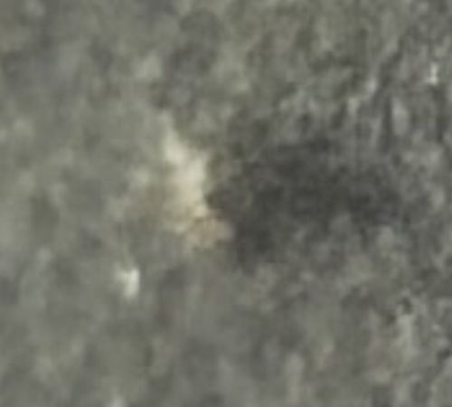 Inconclusive (Image Quality)