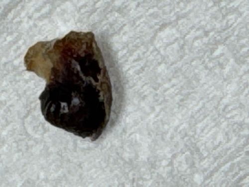 Unknown amorphous object