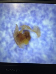 Undetermined micro-organism or cellular debris
