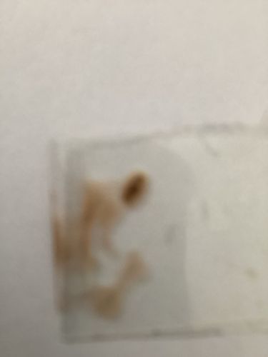 Unidentifiable organism or artifact