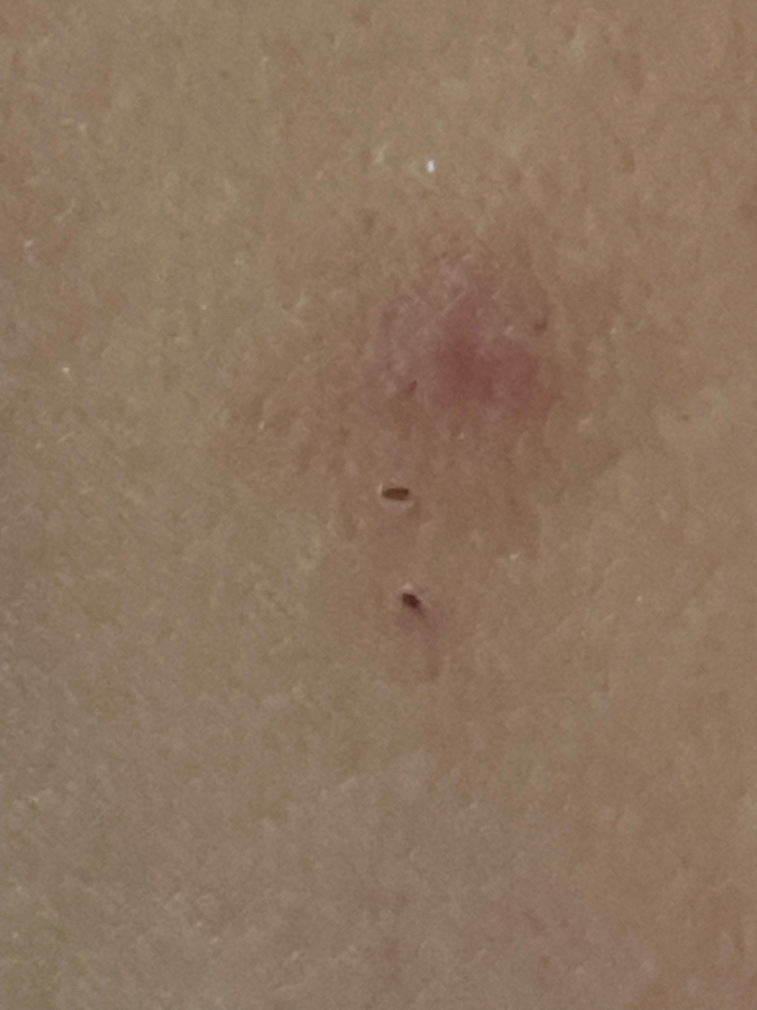 Bed Bug