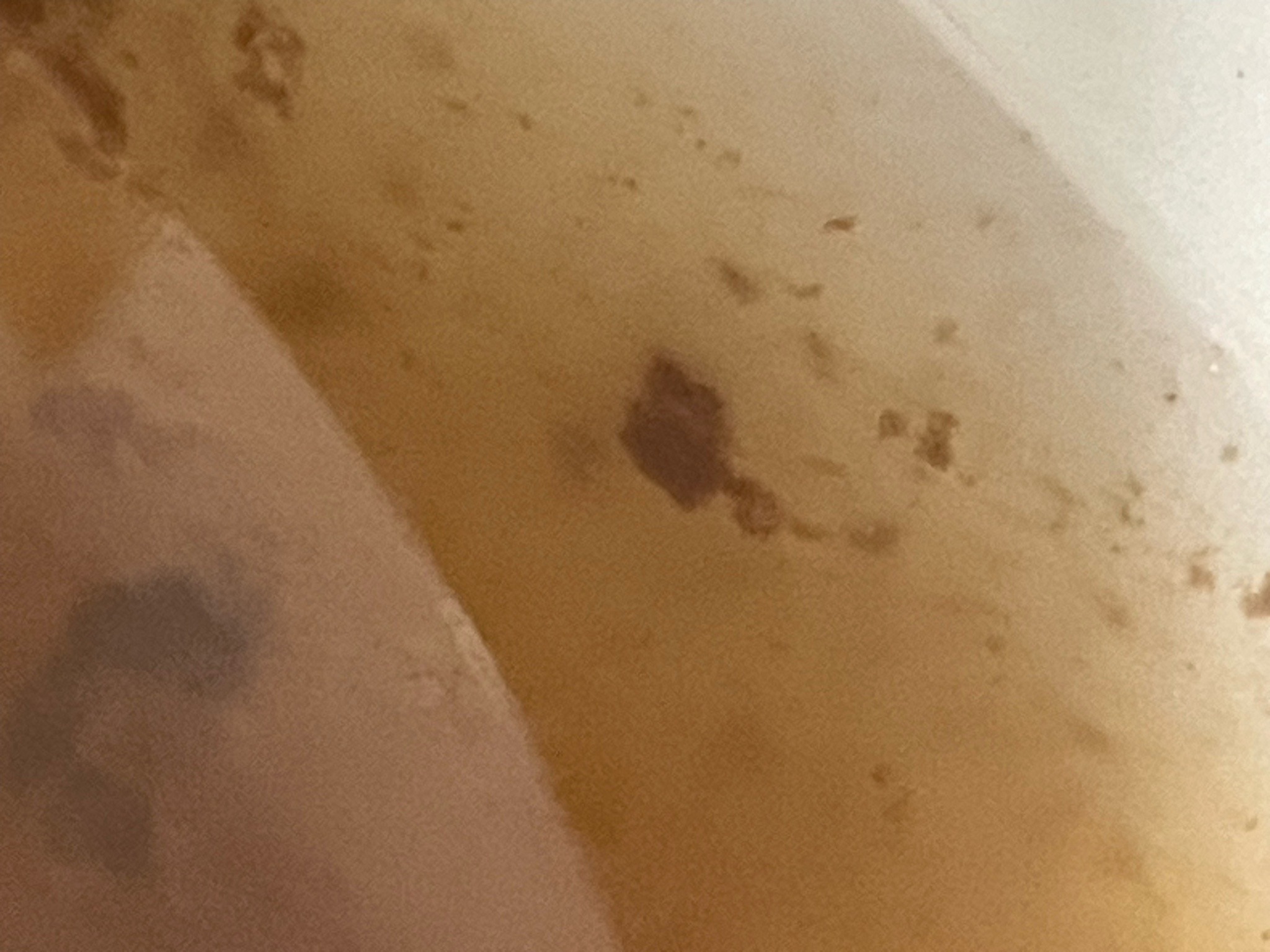 Bed Bug