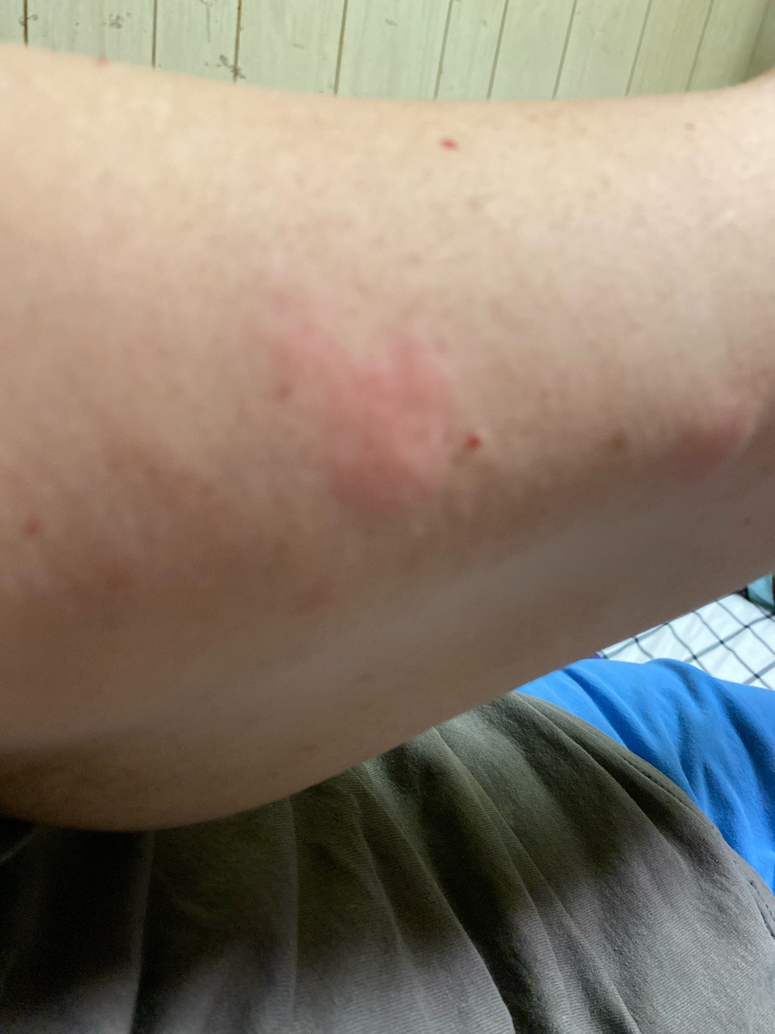 Bed bug