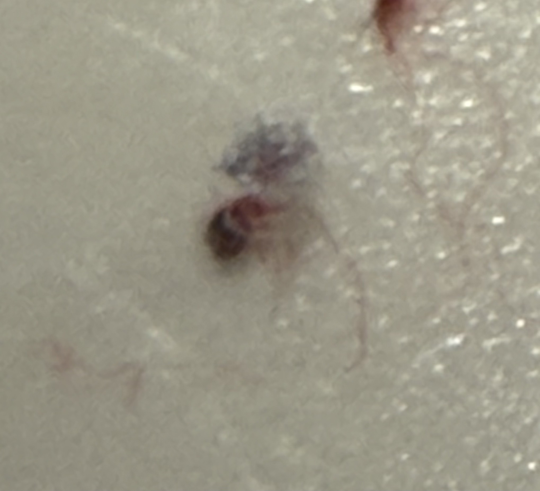 Bed bug (likely nymph)