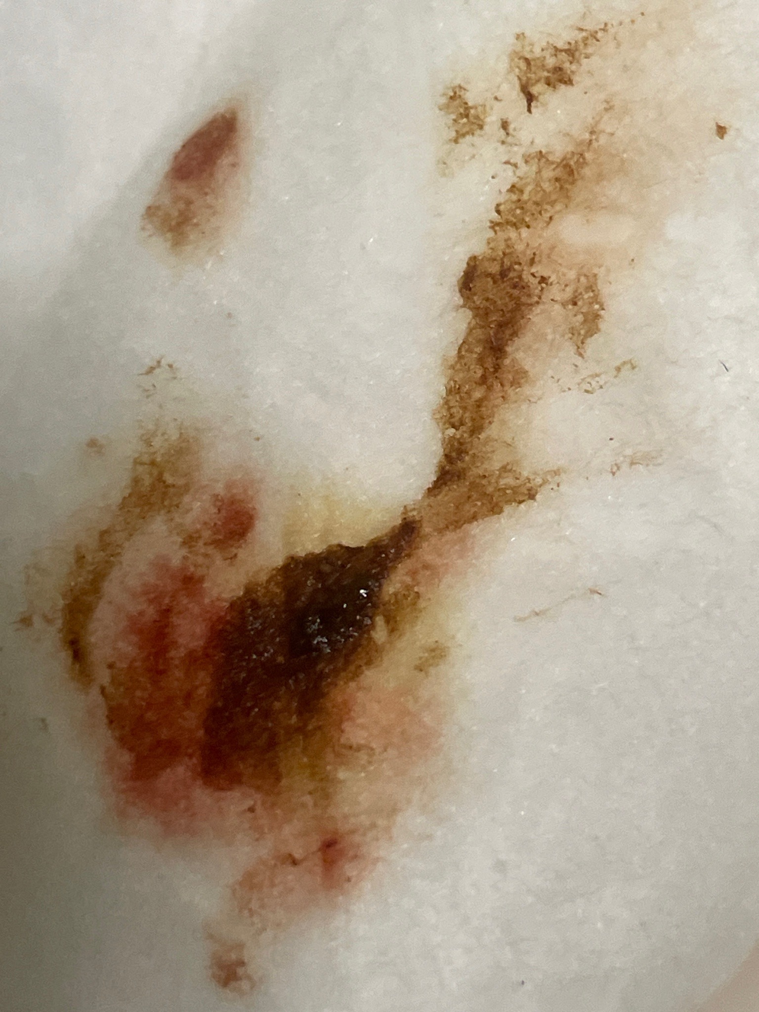 Bed Bug specimen (crushed)