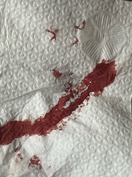 Bed Bug (suspected, based on blood smear evidence)