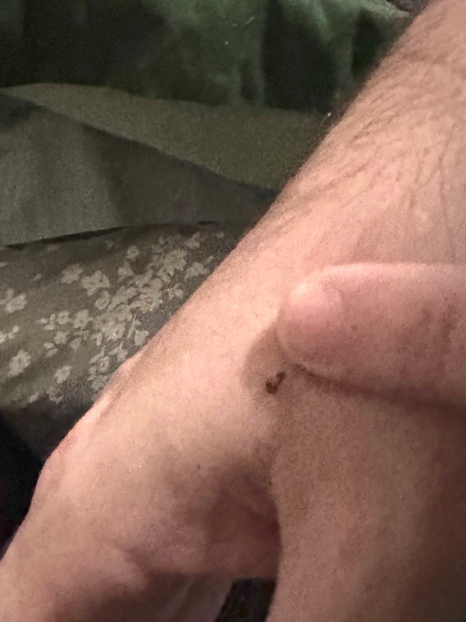 Blacklegged Tick (Deer Tick) / Hard Tick