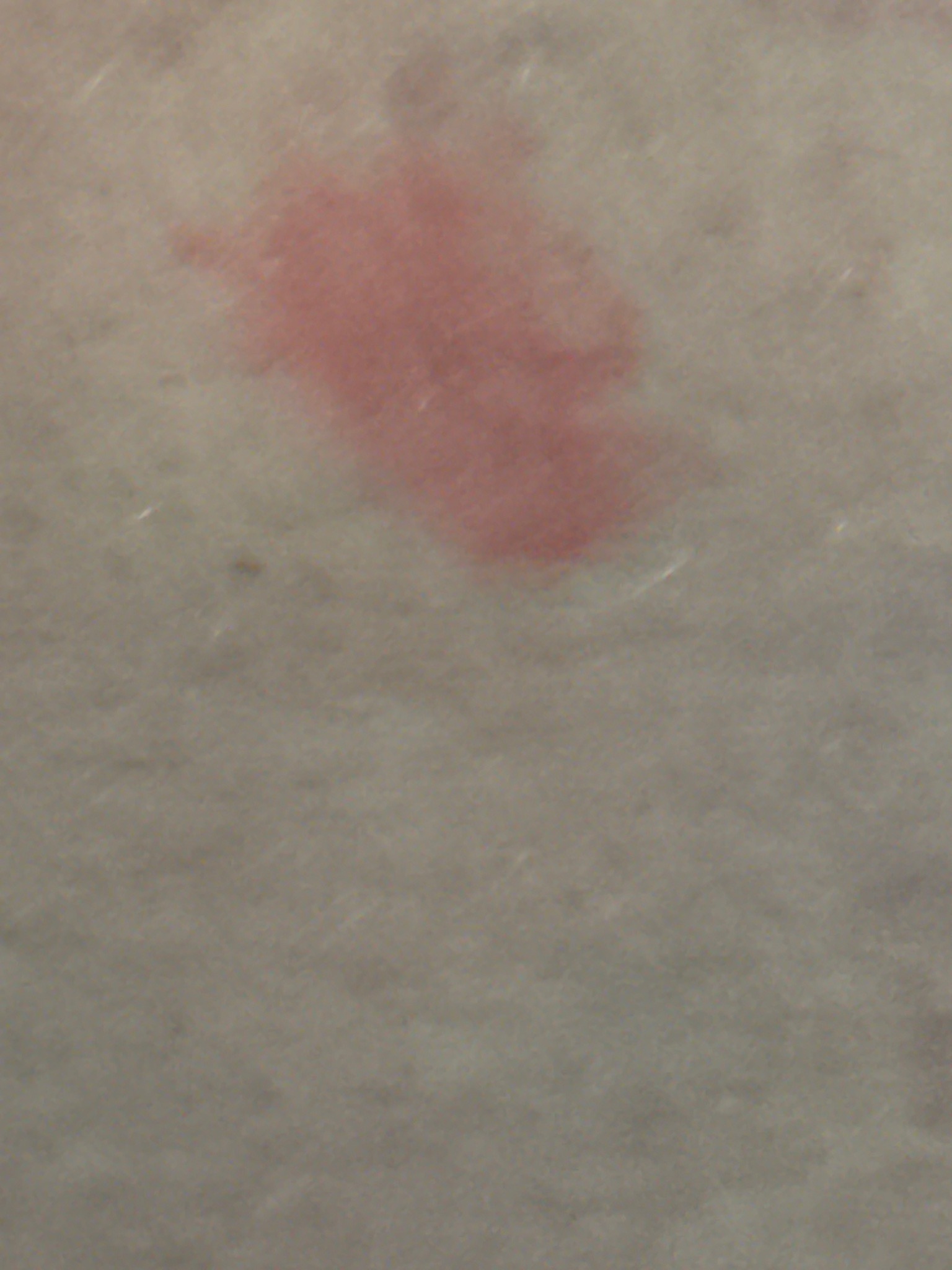 Bloodstain (likely from a bed bug or crushed insect)