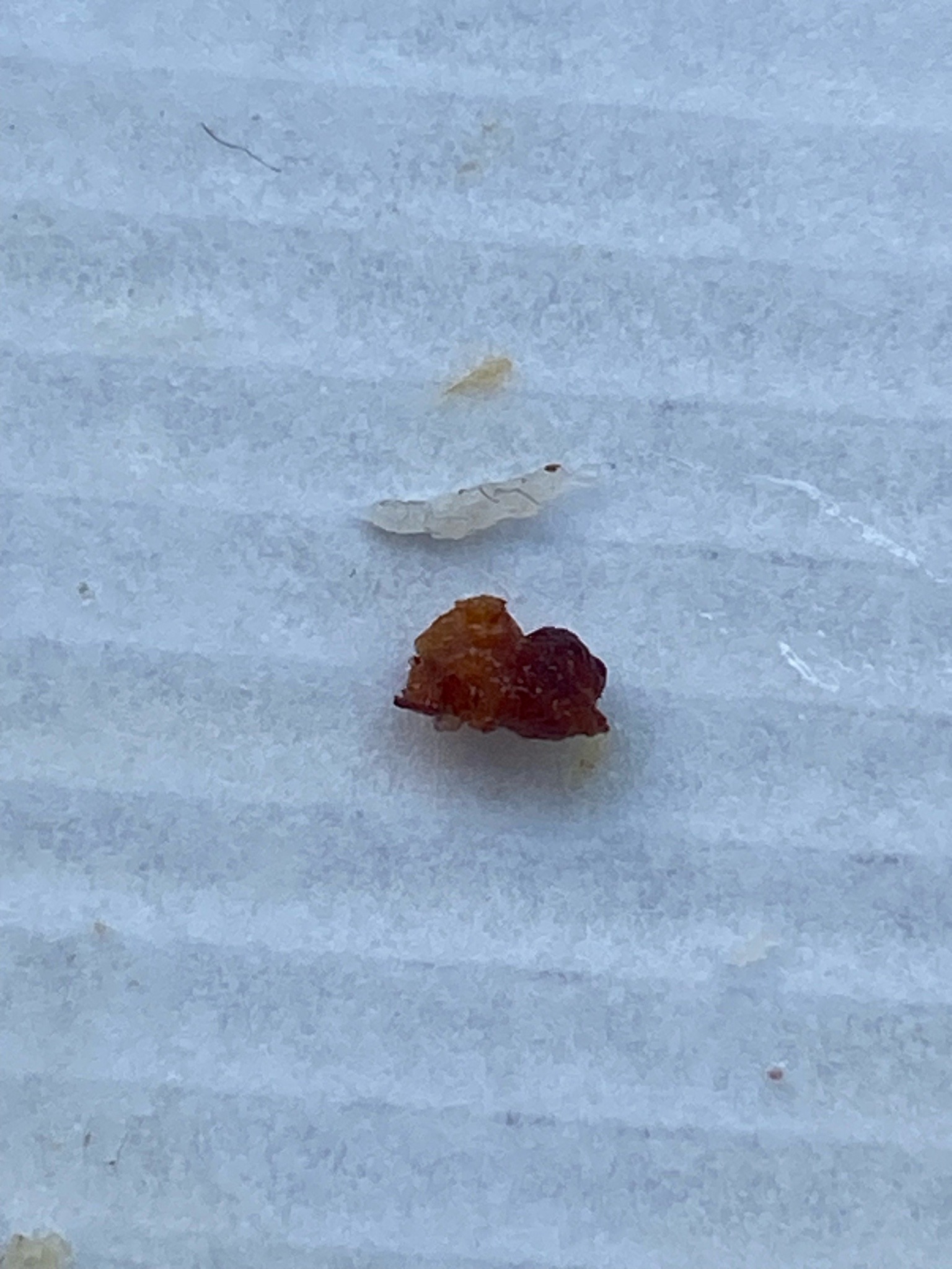 Body Louse