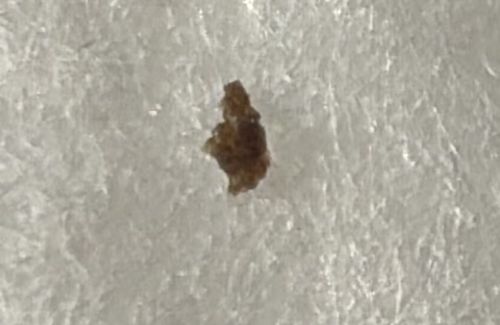 Debris / Artifact (Not a discernible insect)