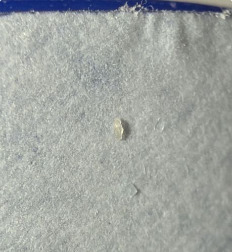 Inconclusive (Likely non-biological debris or skin cell)