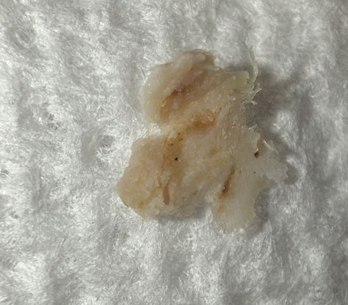 Inconclusive (Likely non-biological debris)