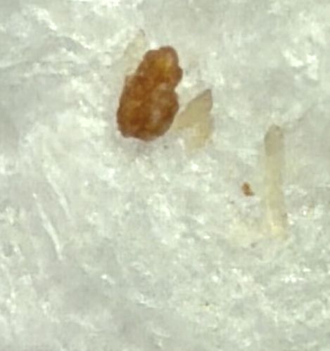Debris / Non-Insect Material (Likely Earwax or Crumb)