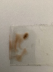 Unidentifiable insect remains/stain