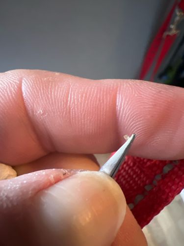 Tick (likely deer tick or similar species)