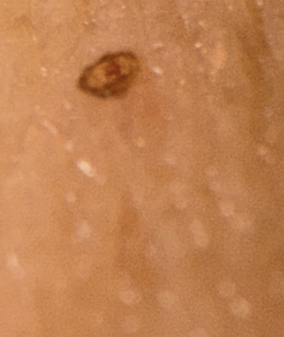 Bed Bug