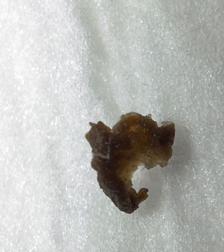 Unknown (Non-biological or heavily degraded sample)