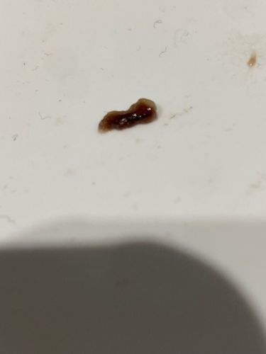 Drain Fly Larva