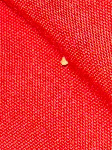 Insect/Arthropod Egg (Possible)