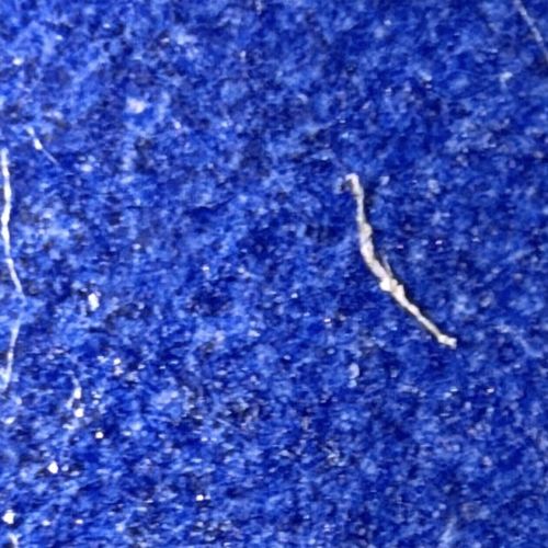 Pinworm
