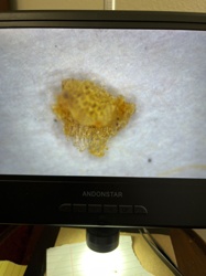 Lace Bug Nymph or Egg Mass