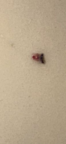 Tick (likely partially crushed and engorged)
