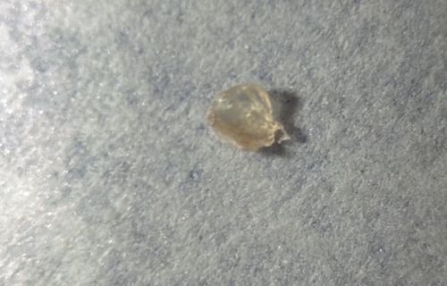 Bed Bug Egg