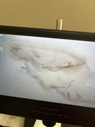 Not an insect/bug; likely textile fibers or dust under magnification