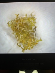 Bagworm Moth (larva)